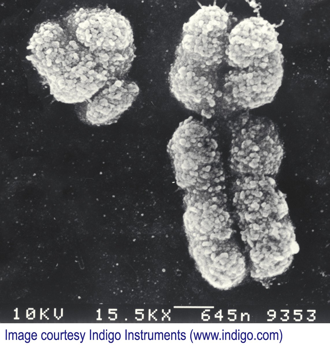 Половые хромосомы мужского организма. Х И У хромосомы под микроскопом. Игрек хромосома. Игрек хромосома под микроскопом. Y хромосома.